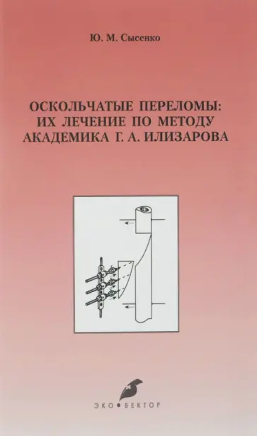 Юрий Сысенко - Оскольчатые переломы. Их лечение по методу академика Г. А. Илизарова. Монография обложка книги