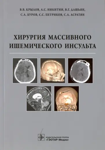 Крылов, Дашьян - Хирургия массивного ишемического инсульта Крылов, Дашьян - Хирургия массивного ишемического инсульта обложка книги