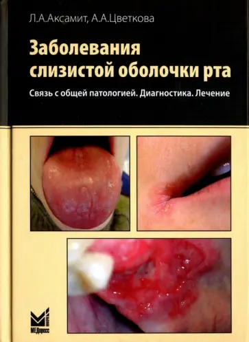 Аксамит, Цветкова - Заболевания слизистой оболочки рта. Связь с общей патологией. Диагностика. Лечение Аксамит, Цветкова - Заболевания слизистой оболочки рта. Связь с общей патологией. Диагностика. Лечение обложка книги