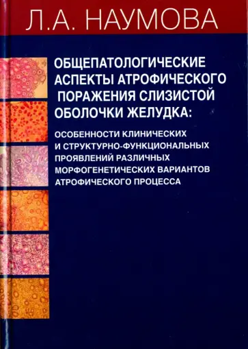 Людмила Наумова - Общепатологические аспекты атрофического поражения слизистой оболочки желудка обложка книги