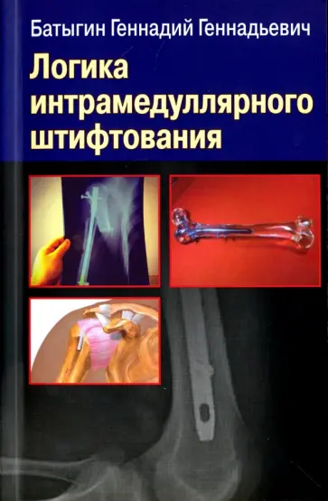 Геннадий Батыгин - Логика интрамедуллярного штифтования обложка книги