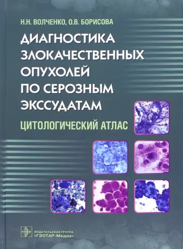 Волченко, Борисова - Диагностика злокачественных опухолей по серозным экссудатам. Цитологический атлас Волченко, Борисова - Диагностика злокачественных опухолей по серозным экссудатам. Цитологический атлас обложка книги
