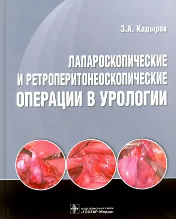 Кадыров, Сулейманов - Лапароскопические и ретроперитонеоскопические операции в урологии Кадыров, Сулейманов - Лапароскопические и ретроперитонеоскопические операции в урологии обложка книги