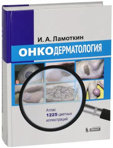 Игорь Ламоткин - Онкодерматология. Атлас. Учебное пособие обложка книги