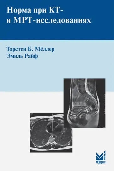 Торстен Меллер - Норма при КТ - и МРТ-исследованиях Торстен Меллер - Норма при КТ - и МРТ-исследованиях обложка книги