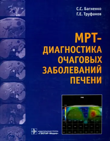 Труфанов, Багненко - МРТ-диагностика очаговых заболеваний печени Труфанов, Багненко - МРТ-диагностика очаговых заболеваний печени обложка книги