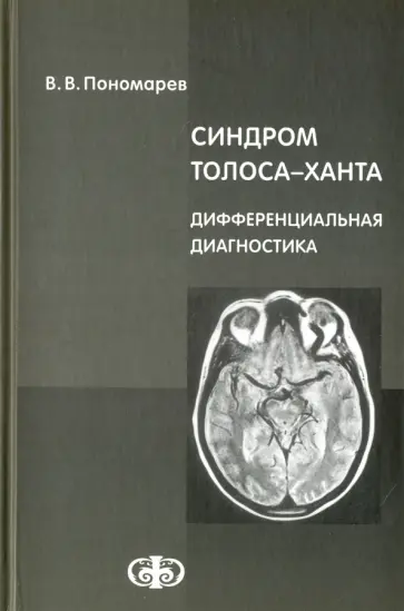 Владимир Пономарев - Синдром Толоса-Ханта. Дифференциальная диагностика (случаи из практики). Руководство для врачей обложка книги