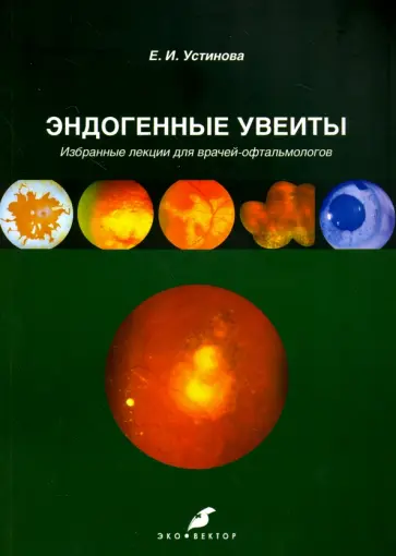 Елена Устинова - Эндогенные увеиты. Избранные лекции для врачей-офтальмологов обложка книги