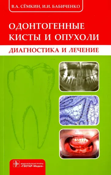 Семкин, Бабиченко - Одонтогенные кисты и опухоли. Диагностика и лечение обложка книги