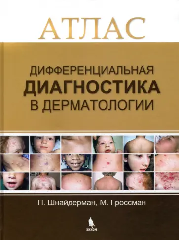 Шнайдерман, Гроссман - Дифференциальная диагностика в дерматологии. Атлас обложка книги