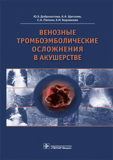 Доброхотова, Щеголев - Венозные тромбоэмболические осложнения в акушерстве Доброхотова, Щеголев - Венозные тромбоэмболические осложнения в акушерстве обложка книги
