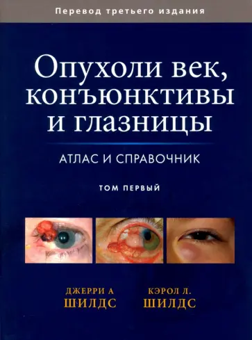 Шилдс, Шилдс - Опухоли век, конъюктивы и глазницы. Атлас и справочник. Том первый Шилдс, Шилдс - Опухоли век, конъюктивы и глазницы. Атлас и справочник. Том первый обложка книги