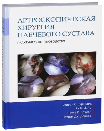 Буркхард, Ло - Артроскопическая хирургия плечвого сустава. Практическое руководство обложка книги