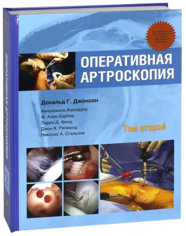 Джонсон, Барбер - Оперативная артроскопия. В 2-х томах. Том 2 обложка книги