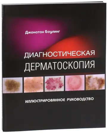 Джонатан Боулинг - Диагностическая дерматоскопия. Иллюстрированное руководство обложка книги