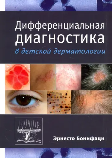 Эрнесто Бонифаци - Дифференциальная диагностика в детской дерматологии обложка книги
