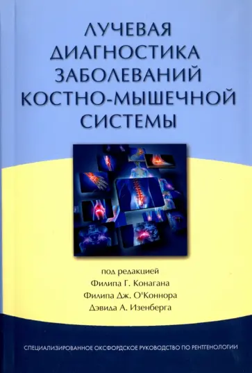 Конаган, О`Коннор - Лучевая диагностика заболеваний костно-мышечной системы обложка книги