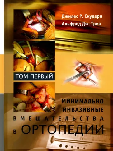 Скудери, Триа - Минимально инвазивные вмешательства в ортопедии. Том 1 обложка книги