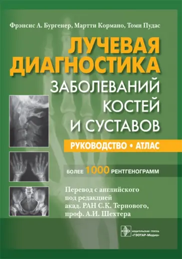 Бургенер, Кормано - Лучевая диагностика заболеваний костей и суставов. Руководство Бургенер, Кормано - Лучевая диагностика заболеваний костей и суставов. Руководство обложка книги