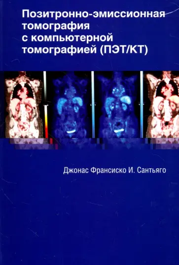 Сантьяго Джонас Франсиско И. - Позитронно-эмиссионная томография с компьютерной томографией (ПЭТ/КТ) обложка книги