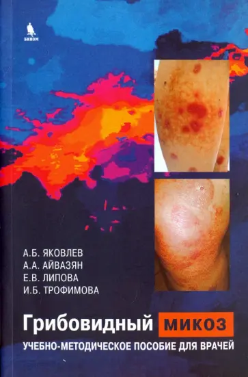 Яковлев, Айвазян - Грибовидный микоз. Учебно-методическое пособие для врачей обложка книги