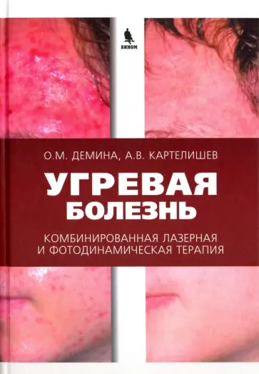 Картелишев, Демина - Угревая болезнь. Комбинированная лазерная и фотодинамическая терапия обложка книги
