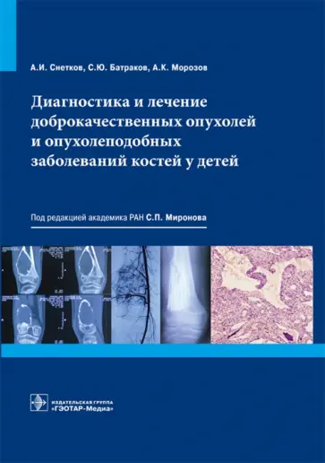 Морозов, Снетков - Диагностика и лечение доброкачественных опухолей и опухолеподобных заболеваний костей у детей Морозов, Снетков - Диагностика и лечение доброкачественных опухолей и опухолеподобных заболеваний костей у детей обложка книги