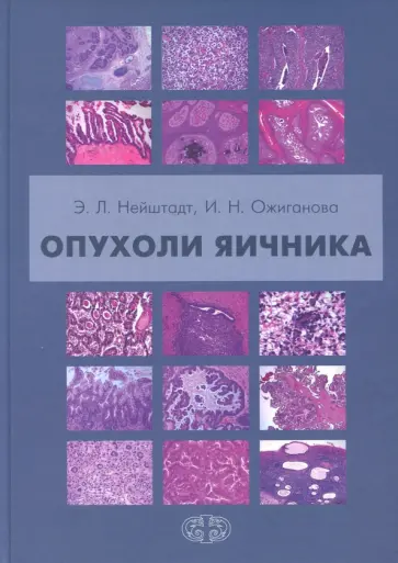 Нейштадт, Ожиганова - Опухоли яичника обложка книги
