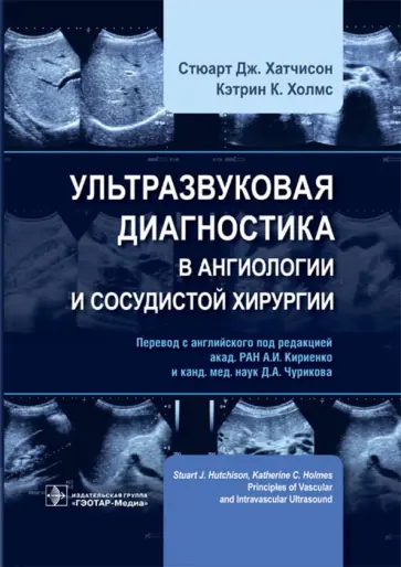 Хатчисон, Холмс - Ультразвуковая диагностика в ангиологии и сосудистой хирургии Хатчисон, Холмс - Ультразвуковая диагностика в ангиологии и сосудистой хирургии обложка книги