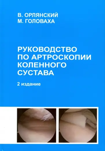 Орлянский, Головаха - Руководство по артроскопии коленного сустава обложка книги