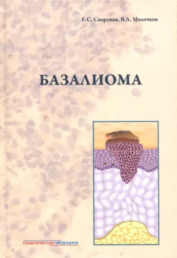 Снарская, Молочков - Базалиома Снарская, Молочков - Базалиома обложка книги