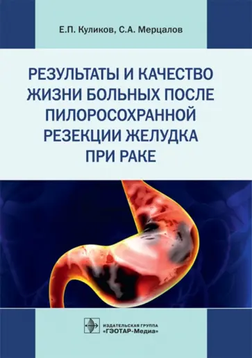 Мерцалов, Куликов - Результаты и качество жизни больных после пилоросохранной резекции желудка при раке Мерцалов, Куликов - Результаты и качество жизни больных после пилоросохранной резекции желудка при раке обложка книги
