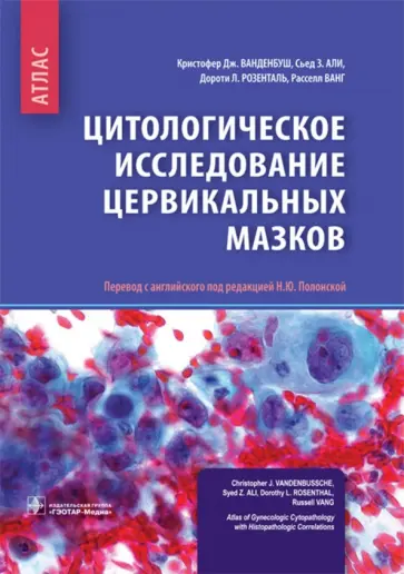Ванденбуш, Али - Цитологические исследование цервикальных мазков. Атлас Ванденбуш, Али - Цитологические исследование цервикальных мазков. Атлас обложка книги