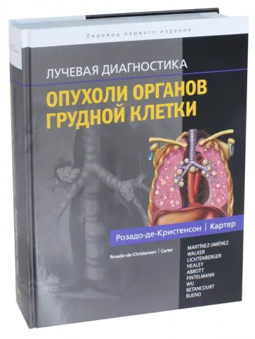 Розадо-де-Кристенсон, Картер - Лучевая диагностика. Опухоли органов грудной клетки обложка книги
