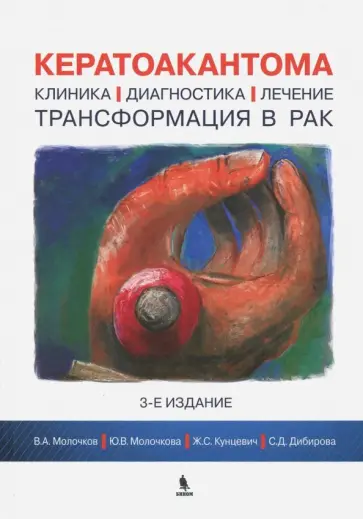 Молочков, Кунцевич - Кератоакантома. Клиника, диагностика, лечение, трансформация в рак Молочков, Кунцевич - Кератоакантома. Клиника, диагностика, лечение, трансформация в рак обложка книги