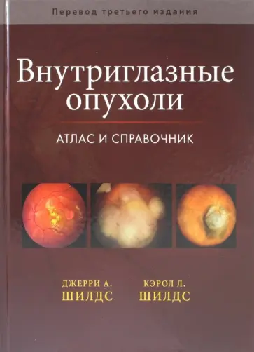 Шилдс, Шилдс - Внутриглазные опухоли. Атлас и справочник Шилдс, Шилдс - Внутриглазные опухоли. Атлас и справочник обложка книги