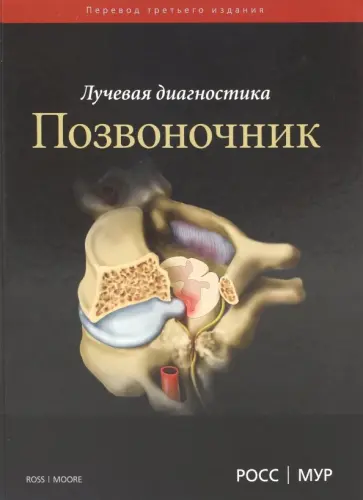 Мур, Росс - Лучевая диагностика. Позвоночник обложка книги