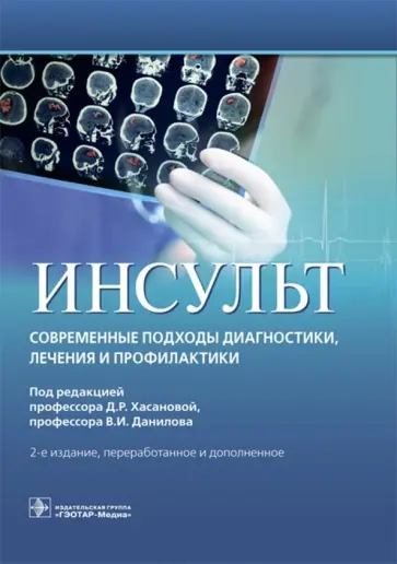 Агафонова, Алексеев - Инсульт. Современные подходы диагностики, лечения и профилактики. Методические рекомендации обложка книги