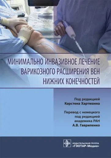 Алм, Брой - Минимально инвазивное лечение варикозного расширения вен обложка книги