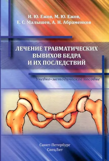 Ежов, Ежов - Лечение травматических вывихов бедра и их последствий. Учебно-методическое пособие Ежов, Ежов - Лечение травматических вывихов бедра и их последствий. Учебно-методическое пособие обложка книги