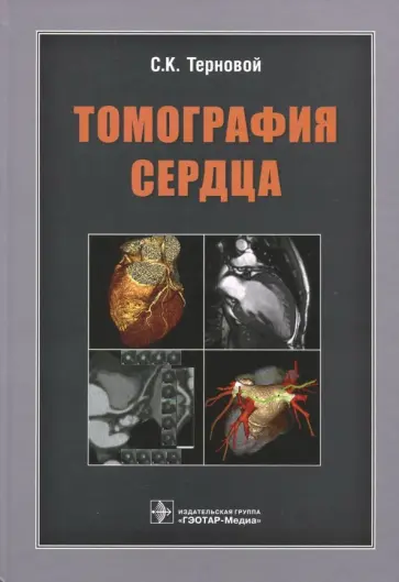 Терновой, Белькинд - Томография сердца. Руководство для врачей Терновой, Белькинд - Томография сердца. Руководство для врачей обложка книги
