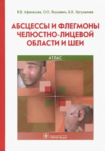 Афанасьев, Янушевич - Абсцессы и флегмоны челюстно-лицевой области и шеи. Атлас. Учебное пособие Афанасьев, Янушевич - Абсцессы и флегмоны челюстно-лицевой области и шеи. Атлас. Учебное пособие обложка книги