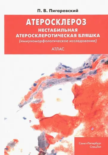 Петр Пигаревский - Атеросклероз. Нестабильная атеросклеротическая бляшка (иммуноморфологическое исследование). Атлас Петр Пигаревский - Атеросклероз. Нестабильная атеросклеротическая бляшка (иммуноморфологическое исследование). Атлас обложка книги