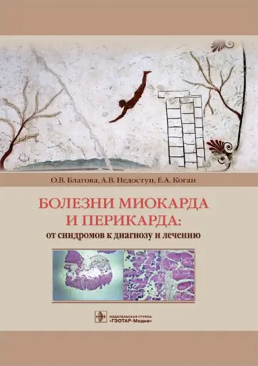 Благова, Недоступ - Болезни миокарда и перикарда. От синдромов к диагнозу и лечению Благова, Недоступ - Болезни миокарда и перикарда. От синдромов к диагнозу и лечению обложка книги