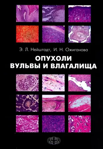 Нейштадт, Ожиганова - Опухоли вульвы и влагалища обложка книги