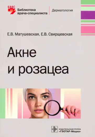 Свирщевская, Матушевская - Акне и розацеа Свирщевская, Матушевская - Акне и розацеа обложка книги