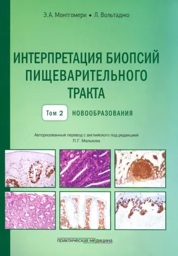 Монтгомери, Вольтаджо - Интерпретация биопсий пищеварительного тракта. Том 2. Новообразования Монтгомери, Вольтаджо - Интерпретация биопсий пищеварительного тракта. Том 2. Новообразования обложка книги