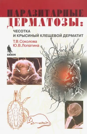 Соколова, Лопатина - Паразитарные дерматозы. Чесотка и крысиный клещевой дерматит Соколова, Лопатина - Паразитарные дерматозы. Чесотка и крысиный клещевой дерматит обложка книги