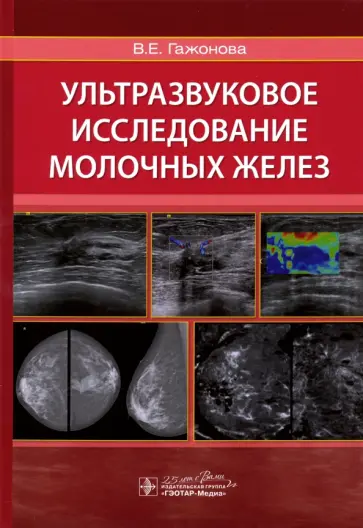 Вероника Гажонова - Ультразвуковое исследование молочных желез. Руководство обложка книги