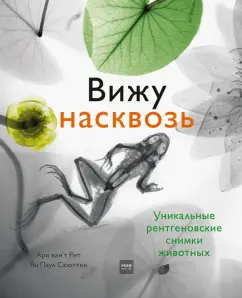 Медики из Воронежа показали рентгеновские снимки малышей с инородными телами в организме